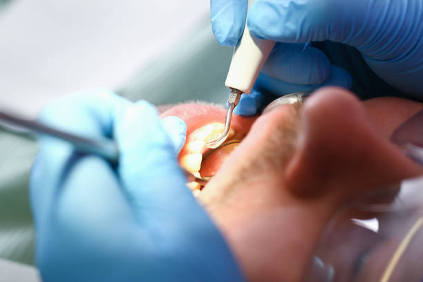 Best Emergency Treatment for Dental Infections or Abscesses in Vian, OK