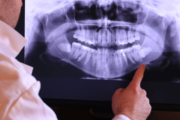 Best Emergency Dental Care for Broken or Chipped Teeth in Vian, OK